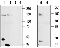 TRPM8 (extracellular) Blocking Peptide