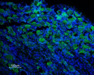 Anti-TRPM8 (extracellular) Antibody