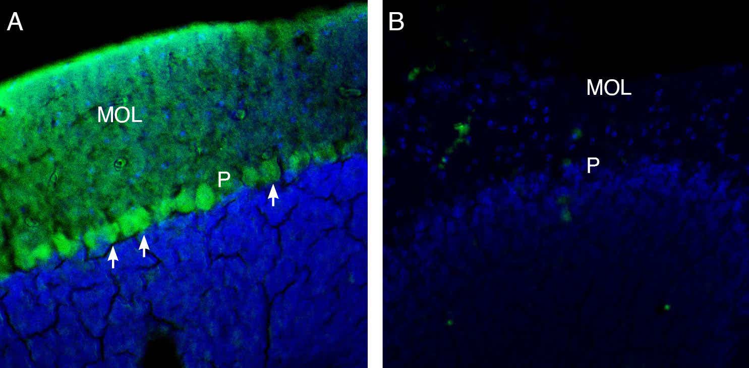 Anti-TRPM3 (extracellular) Antibody