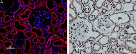 Anti-TRPP1 (PKD2) Antibody