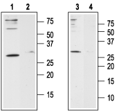 Human Orai1 (extracellular) Blocking Peptide