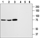 STIM1 (extracellular) Blocking Peptide