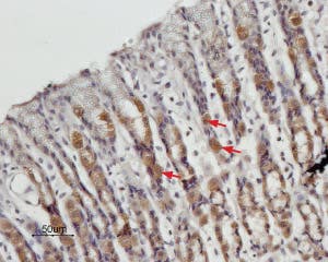 Anti-STIM1 (extracellular) Antibody