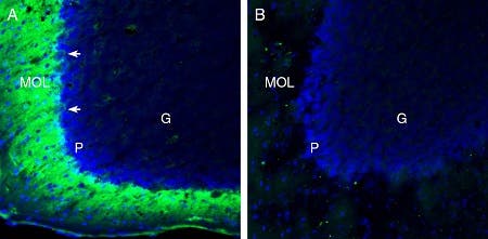 Anti-TMEM66 Antibody