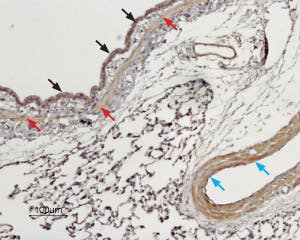 Anti-TPCN1 Antibody