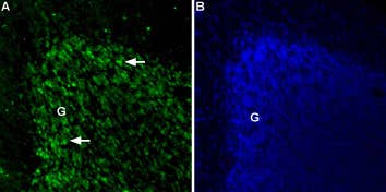 Anti-TPCN2 Antibody