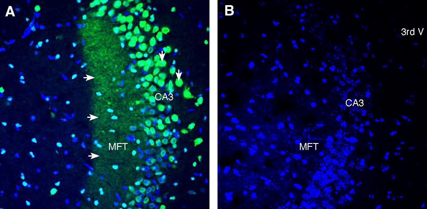 Anti-TRPML1 (Mucolipin 1) Antibody