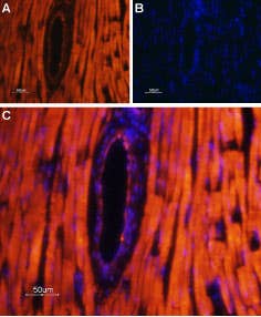 Anti-TRPML2 (Mucolipin-2) Antibody