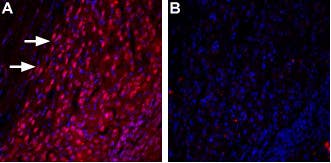 Anti-TRPML3 (Mucolipin 3)-ATTO Fluor-594 Antibody