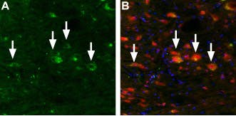 Anti-TRPML3 (Mucolipin 3) Antibody