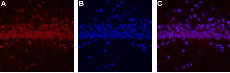 Anti-CALHM1-ATTO Fluor-594 Antibody