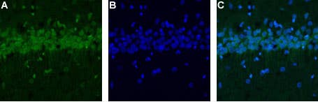 Anti-CALHM1 Antibody