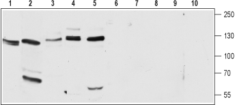 CACNA2D2/Cavα2δ2 (extracellular) Blocking Peptide