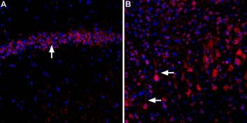 Anti-CACNA2D3 (Ca<sub>V</sub>α2δ3) (extracellular)-ATTO Fluor-594 Antibody