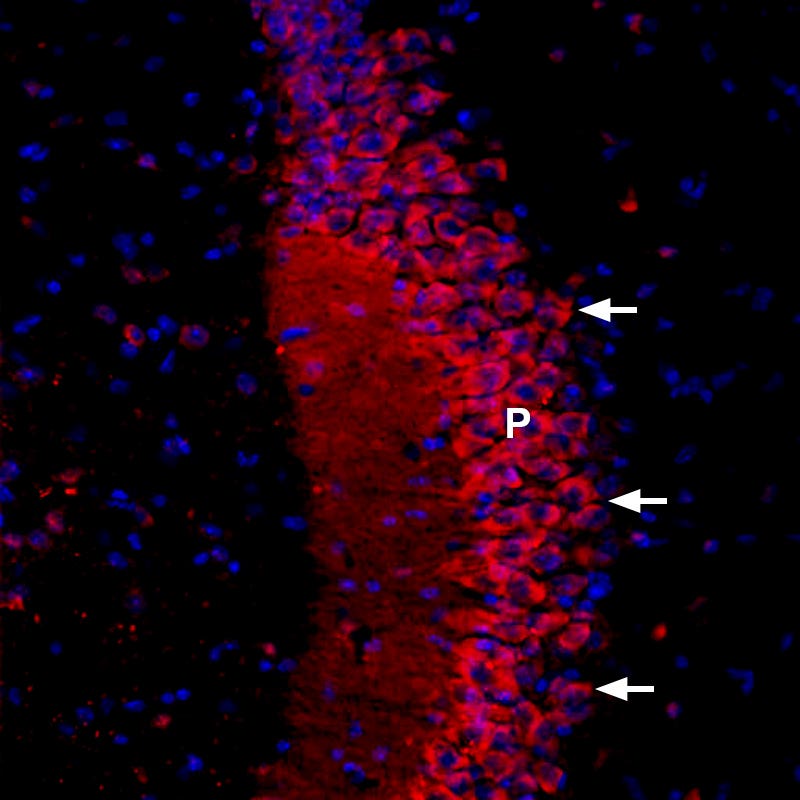 Anti-CACNB2-ATTO Fluor-594 Antibody