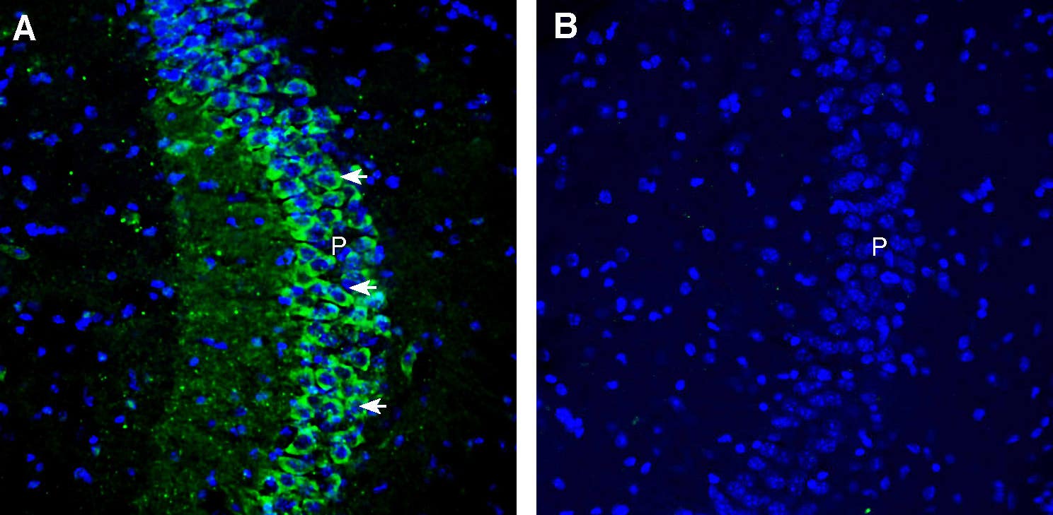Anti-CACNB2 Antibody