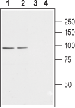 CACNB2 Blocking Peptide