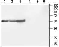 CACNB1 Blocking Peptide