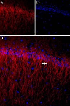 Anti-CACNB1 Antibody