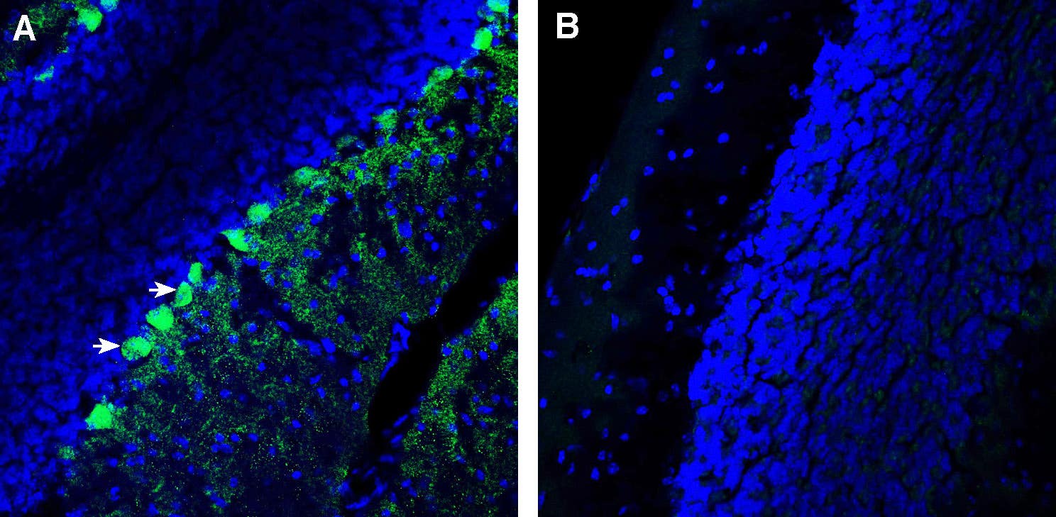 Anti-CACNG7 (extracellular) Antibody