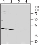 CACNG7 (extracellular) Blocking Peptide