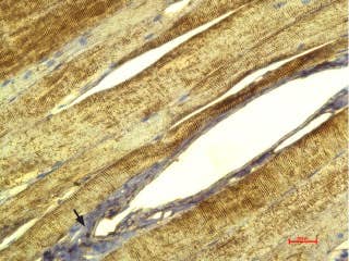 Anti-CACNG1 (extracellular) Antibody