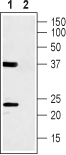 Anti-CACNG1 (extracellular) Antibody - Carrier Free