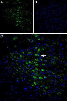 Anti-CACNG6 (extracellular) Antibody