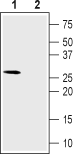 CACNG6 (extracellular) Blocking Peptide