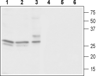 Anti-CACNG3 Antibody