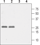 Anti-CACNG5 (extracellular) Antibody
