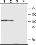 TRPC4 (extracellular) Blocking Peptide