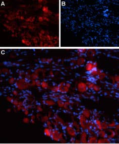 Anti-TRPV4 (extracellular) Antibody