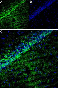 Anti-CACNG8 Antibody
