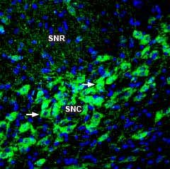 Anti-TRPM2 (extracellular) Antibody