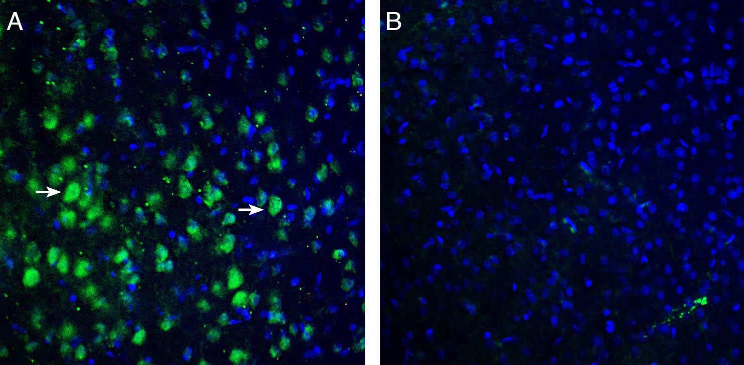 Anti-TRPM7 (extracellular) Antibody