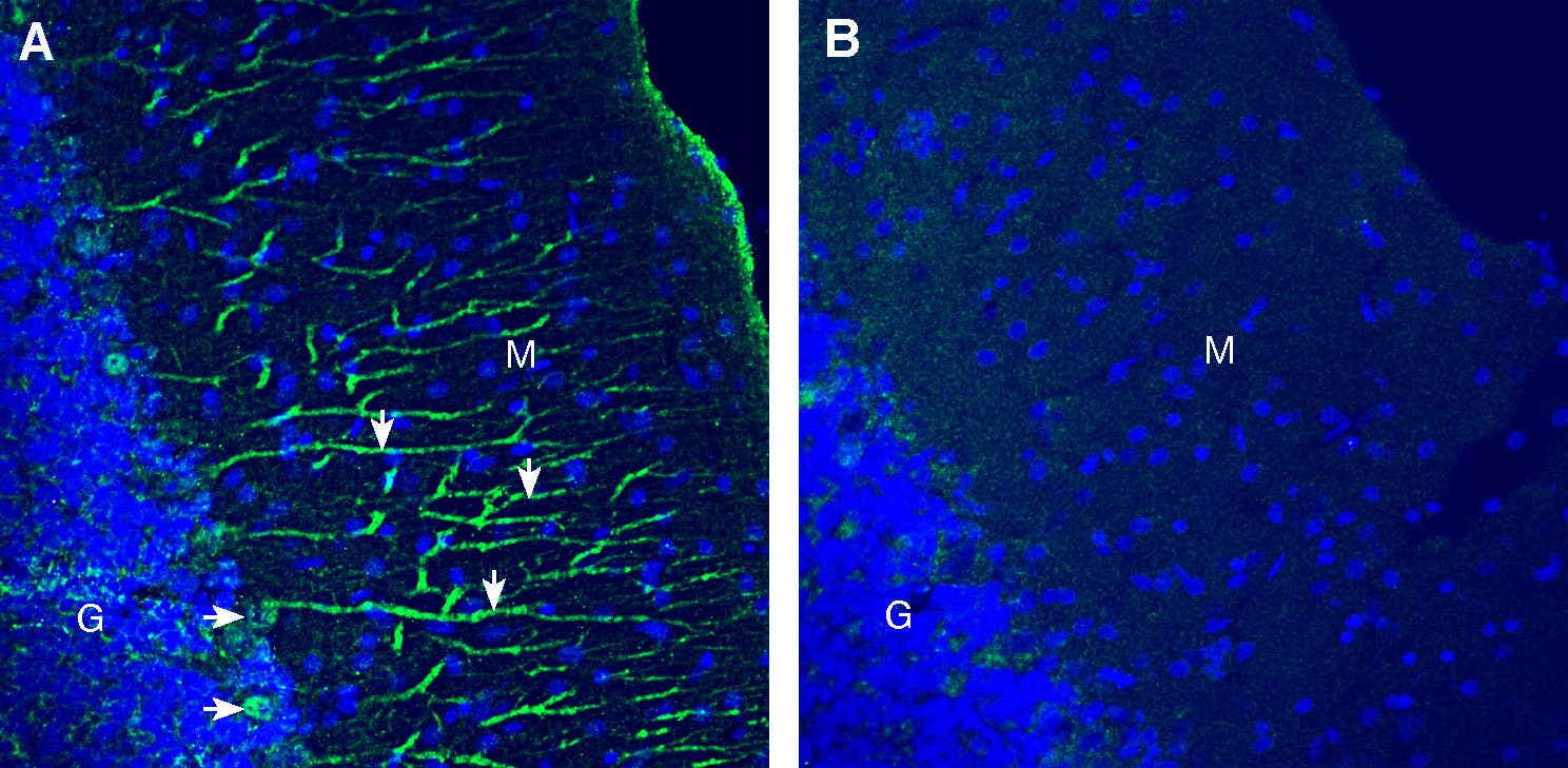 Anti-Ca<sub>V</sub>1.2 (CACNA1C) (extracellular) Antibody