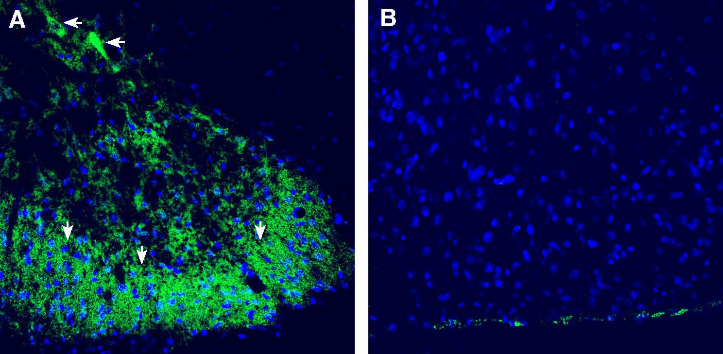 Anti-CALHM2 (extracellular) Antibody