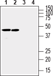Anti-Connexin-31 (GJB3) Antibody