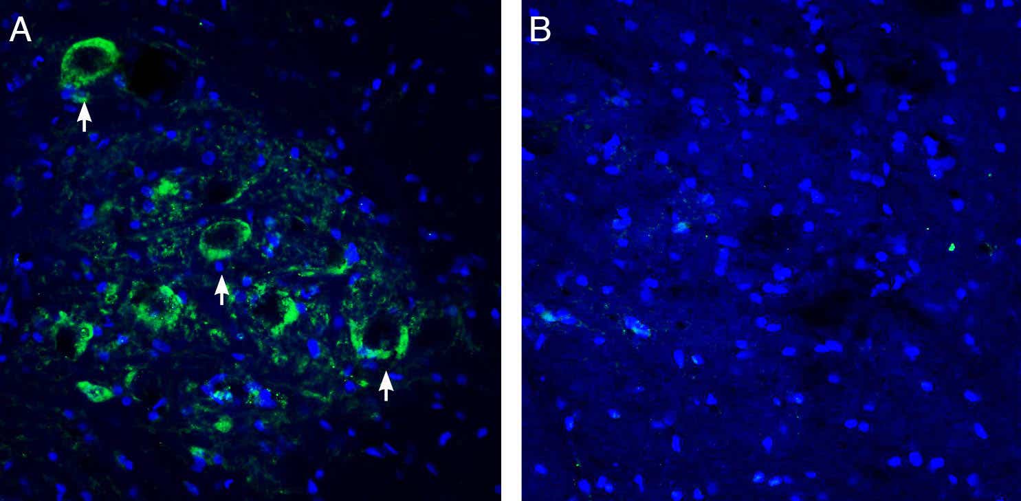 Anti-Connexin-47 (GJC2) Antibody
