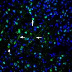 Anti-Pannexin 1 Antibody
