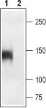 Cav1.1/CACNA1S (extracellular) Blocking Peptide