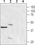Anti-CRACR2A (EFCAB4B) Antibody