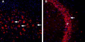 Anti-CHERP-ATTO Fluor-594 Antibody