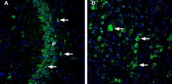 Anti-CHERP Antibody