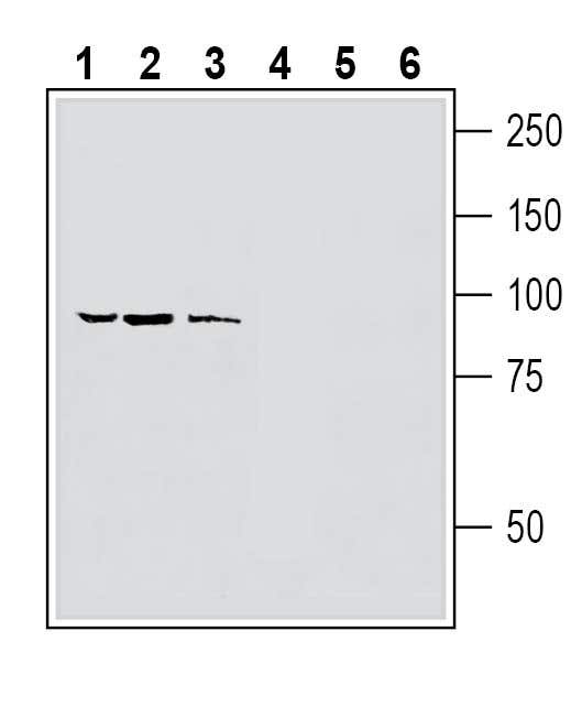 Anti-Human TRPV1 (extracellular) Antibody