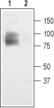 CLC-3/CLCN3 Blocking Peptide