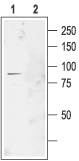 CLC-2/CLCN2 Blocking Peptide
