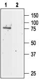 Anti-CLC-5 Antibody