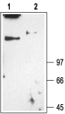 CLC-1/CLCN1 Blocking Peptide